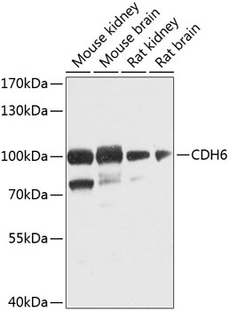 CDH6 Antibody抗体，orb1255991，bio