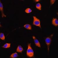 Adseverin Antibody抗体，orb668043