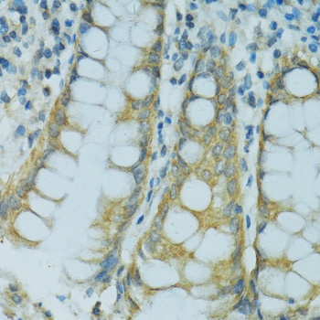 CYP2B6 Antibody抗体,orb1259860,b