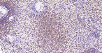 5 Lipoxygenase Recombinant Rab