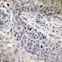 hnRNP D0 (Phospho-S83) Antibod