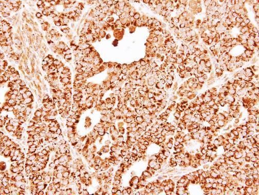 DECR1 antibody [N1C3]抗体，orb556