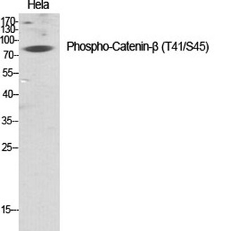 Catenin-β (phospho Thr41/S45) 