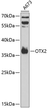 OTX2 Antibody抗体，orb1254855，bio