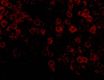 TIP47 Antibody抗体，orb1240193，bi