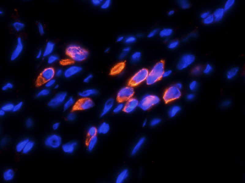 HE4 antibody抗体，orb101171，biorb