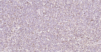 STMN1 Mouse Monoclonal Antibod