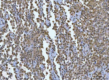 AREB6/ZEB1 Antibody (monoclona