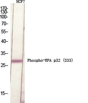 RPA p32 (phospho Ser33) rabbit