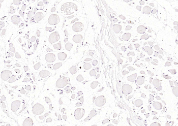 Cardiac Troponin I/TNIC Mouse 