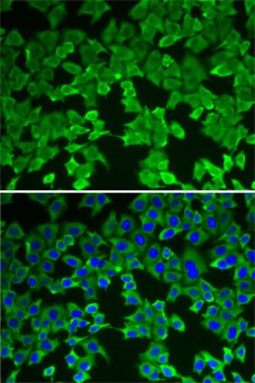 MTAP Antibody抗体,orb1261439,bio
