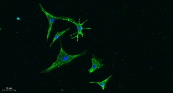 Vinculin rabbit pAb抗体，orb76657