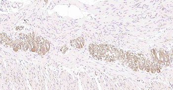 Tau-4 Mouse Monoclonal Antibod