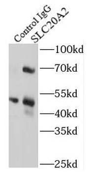 SLC20A2 Antibody抗体，orb631233，b