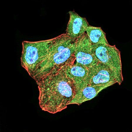 CBX2 Antibody抗体，orb333960，bior