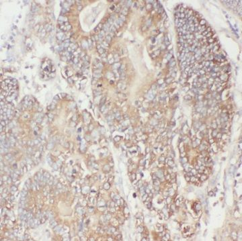 TTC1 Antibody抗体，orb632232，bior