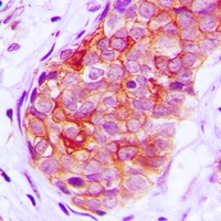 GRK6 Antibody抗体，orb214004，bior