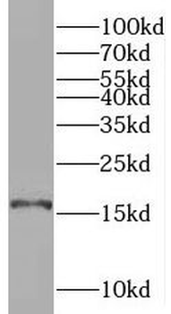 SYNJ2BP Antibody抗体，orb631678，b
