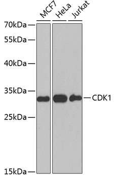 CDK1 Antibody抗体，orb1260935，bio