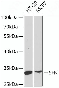 SFN Antibody抗体，orb1261573，bior