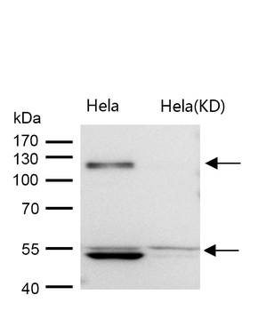 ORP1 Rabbit mAb [KD Validated]