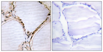 Bmx rabbit pAb抗体,orb764658,bio