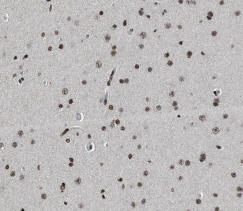 STXBP1 Antibody抗体，orb631619，bi