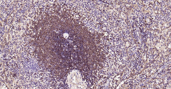 Bcl-2 Recombinant Rabbit Monoc