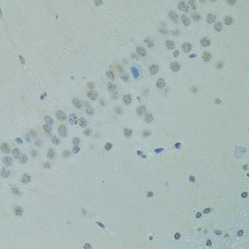 CTAG1B Antibody抗体，orb1255572，b