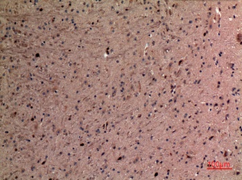 AFP rabbit pAb抗体，orb766745，bio