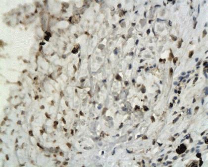 Elastin antibody抗体，orb13391，bi