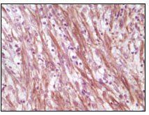 Desmin Antibody抗体，orb69005，bio