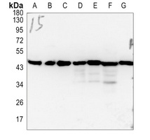 FoxD4L5 Antibody抗体,orb234847,b