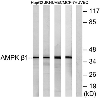 AMPKβ1 rabbit pAb抗体，orb764525，