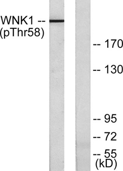 WNK1 (phospho Thr60) rabbit pA