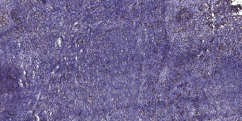 ADAMTS-17 rabbit pAb抗体，orb7678