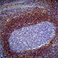 BCL2 Antibody抗体，orb323096，bior