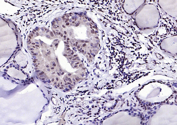 THRB Rabbit Polyclonal Antibod