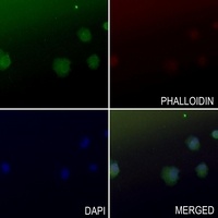 Arylsulfatase B Antibody抗体，orb