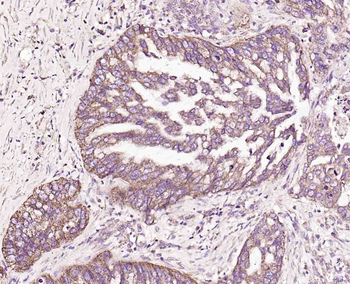CD48 Rabbit Polyclonal Antibod