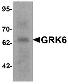 GRK6 Antibody抗体，orb1239726，bio