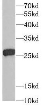 TIMP2 Antibody抗体，orb631910，bio