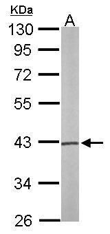 PSAT1 antibody [N1C3]抗体，orb556