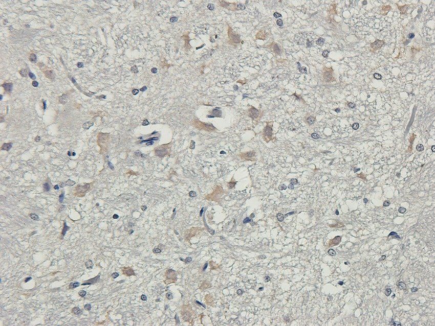 SLC6A5 antibody抗体，orb395803，bi