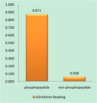 Tuberin (phospho Thr1462) rabb
