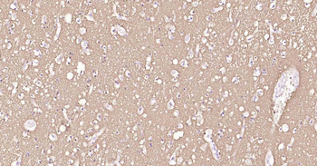 Tau-4 Mouse Monoclonal Antibod