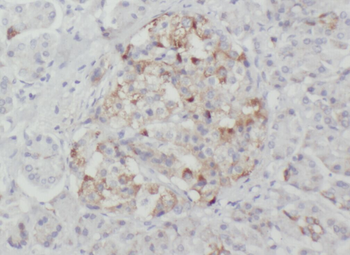 WSB2 Antibody抗体，orb632625，bior