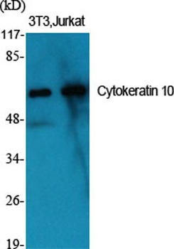 Cytokeratin 10 rabbit pAb抗体，or
