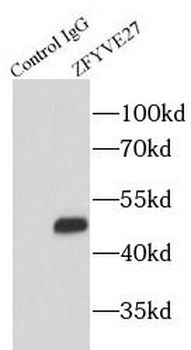 ZFYVE27 Antibody抗体，orb632722，b