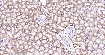 ATP1B1 Recombinant Rabbit Mono